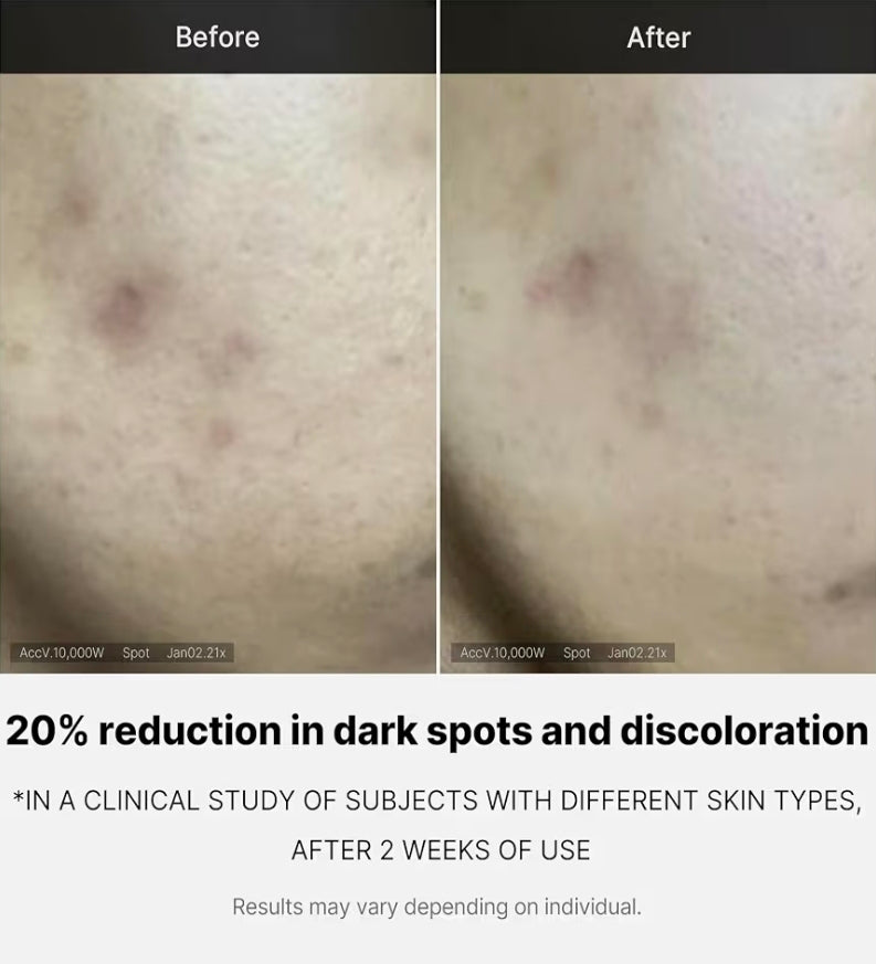 Medicube Deep Vita C Serum 2.0 (10g * 3 bottles)